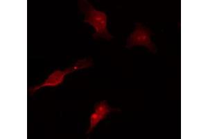 Immunofluorescence (fixed cells) (IF/ICC) image for anti-Mitogen-Activated Protein Kinase Kinase Kinase 7 (MAP3K7) (pThr187) antibody (ABIN6256492)