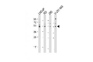 All lanes : Anti-OTUD3 Antibody (Center) at 1:2000 dilution Lane 1: LNCaP whole cell lysate Lane 2: RD whole cell lysate Lane 3: 293 whole cell lysate Lane 4: U-251 MG whole cell lysate Lysates/proteins at 20 μg per lane. (OTUD3 抗体  (AA 192-220))