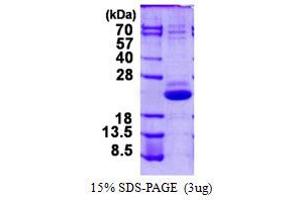 Image no. 1 for Vacuolar Protein-Sorting-Associated Protein 25 (VPS25) protein (His tag) (ABIN1098226)