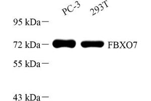 Western blot analysis of FBXO7 (ABIN7073906) at dilution of 1: 500 (FBXO7 抗体)