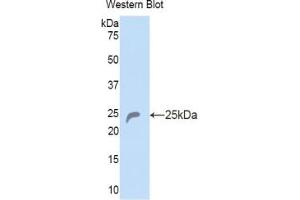 Western blot analysis of the recombinant protein. (COL6A1 抗体  (AA 816-1002))