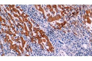 Immunohistochemistry (IHC) image for anti-B-Cell CLL/lymphoma 2 (BCL2) (AA 2-211) antibody (ABIN7432577)