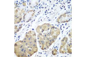Immunohistochemistry of paraffin-embedded human stomach using PLCB2 antibody (ABIN5974500) at dilution of 1/100 (40x lens). (Phospholipase C beta 2 抗体)