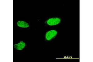 Image no. 1 for anti-Activating Transcription Factor 2 (ATF2) (AA 1-210) antibody (ABIN598626) (ATF2 抗体  (AA 1-210))