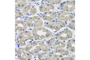 Immunohistochemistry of paraffin-embedded human stomach using HSD11B2 antibody (ABIN5995471) at dilution of 1/100 (40x lens). (HSD11B2 抗体)