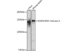 Western blot analysis of extracts of various cell lines, using DHX9/DHX9/RNA Helicase A Rabbit mAb (ABIN7265747) at 1:1000 dilution. (DHX9 抗体)