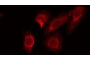 ABIN6275564 staining Hela by IF/ICC. (STAC2 抗体  (Internal Region))