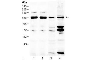 Western blot testing of 1) rat brain, 2) mouse brain, 3) human MCF7 and 4) human 293T lysate with NCKAP1 antibody at 0. (NCKAP1 抗体)