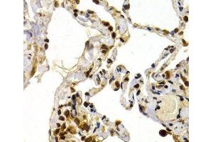 Immunohistochemistry of paraffin-embedded Human lung using TFDP1 Polyclonal Antibody at dilution of 1:200 (40x lens). (DP1 抗体)