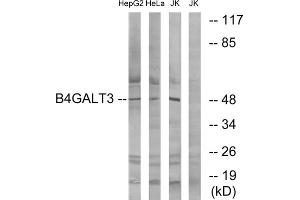 Western blot analysis of extracts from HepG2 cells, HeLa cells and Jurkat cells, using B4GALT3 antibody. (B4GALT3 抗体  (Internal Region))