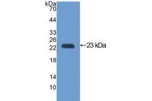 Detection of Recombinant VCAM1, Mouse using Polyclonal Antibody to Vascular Cell Adhesion Molecule 1 (VCAM1) (VCAM1 抗体  (AA 116-309))