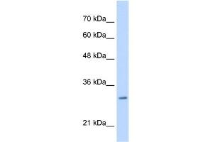 WB Suggested Anti-MLF2 Antibody Titration:  0. (MLF2 抗体  (C-Term))