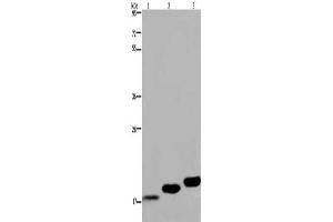 Gel: 8 % SDS-PAGE, Lysate: 40 μg, Lane 1-3: Mouse skeletal muscle, Mouse heart tissue, Mouse bladder tissue, Primary antibody: ABIN7130317(MYL12B Antibody) at dilution 1/450, Secondary antibody: Goat anti rabbit IgG at 1/8000 dilution, Exposure time: 20 seconds (MYL12B 抗体)