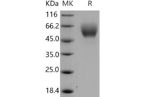 SERPINA6 Protein (His tag)