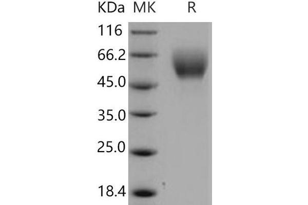 SERPINA6 Protein (His tag)