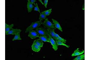 Immunofluorescent analysis of Hela cells using ABIN7157579 at dilution of 1:100 and Alexa Fluor 488-congugated AffiniPure Goat Anti-Rabbit IgG(H+L) (KIF11 抗体  (AA 920-1038))
