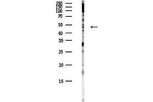 Western blot analysis of lysates from COLO205 cells(heat-shock,45 min treatment), using LNP Antibody at 1/1000 dilution. (Lunapark 抗体)