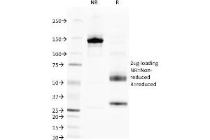 SDS-PAGE (SDS) image for anti-Alkaline Phosphatase, Liver/bone/kidney (ALPL) antibody (ABIN6939449)