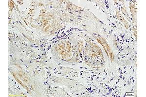 Formalin-fixed and paraffin embedded: dog bladder tissue labeled with Anti-Actin A/Alpha SMA Polyclonal Antibody, Unconjugated (ABIN726050) at 1:300, followed by conjugation to the secondary antibody. (Actin 抗体)