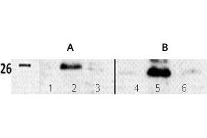 Image no. 3 for anti-Twist Homolog 1 (Drosophila) (TWIST1) (N-Term) antibody (ABIN347415) (TWIST1 抗体  (N-Term))