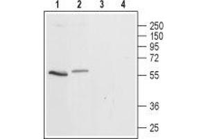 Western blot analysis of rat (lanes 1 and 3) and mouse (lanes 2 and 4) brain lysates: - 1,2. (Serotonin Receptor 3A 抗体  (2nd Cytoplasmic Loop))