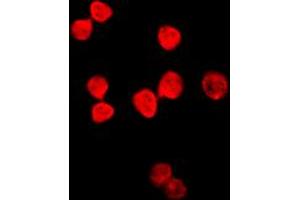 Immunofluorescent analysis of Thymine DNA Glycosylase staining in HeLa cells. (TDG 抗体  (Center))