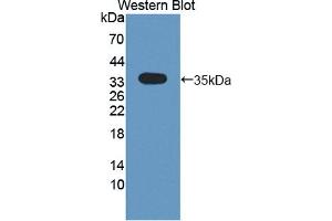 Western blot analysis of the recombinant protein. (CRLF1 抗体  (AA 110-408))