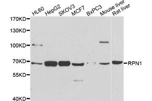 Western blot analysis of extracts of various cell lines, using RPN1 antibody. (RPN1 抗体)