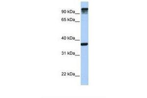 Image no. 1 for anti-Epidermal Growth Factor Receptor Pathway Substrate 15 (EPS15) (AA 794-843) antibody (ABIN6738963)