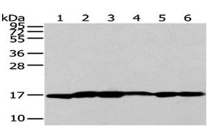 Western Blot analysis of A431 cells and Human liver cancer tissue, Lovo and PC3 cells, Human placenta tissue and 293T cells using UTS2B Polyclonal Antibody at dilution of 1/200 (Urotensin 2B 抗体)