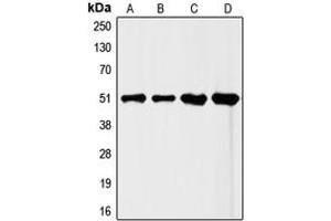 Western blot analysis of FLI1 expression in HeLa (A), Jurkat (B), mouse liver (C), rat liver (D) whole cell lysates. (FLI1 抗体  (Center))