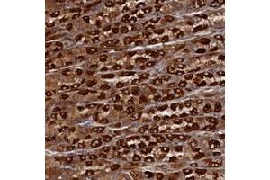 Immunohistochemical staining of human stomach with TMEM196 polyclonal antibody  shows strong cytoplasmic positivity in parietal cells at 1:50-1:200 dilution. (TMEM196 抗体)