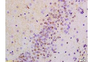 Immunohistochemistry (Paraffin-embedded Sections) (IHC (p)) image for anti-Protein Kinase, AMP-Activated, alpha 1 Catalytic Subunit (PRKAA1) (AA 351-450) antibody (ABIN737886)