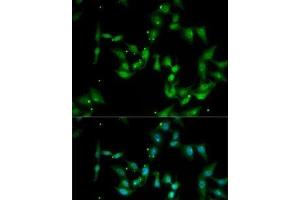Immunofluorescence analysis of MCF7 cells using IL17F Polyclonal Antibody (IL17F 抗体)