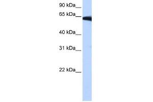 PIGW antibody used at 0. (PIGW 抗体  (Middle Region))