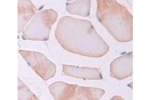 IHC-P analysis of Rat Tissue, with DAB staining. (Thrombospondin 1 抗体  (AA 957-1129))