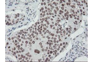 Image no. 9 for anti-SUMO1/sentrin/SMT3 Specific Peptidase 2 (SENP2) (AA 139-523) antibody (ABIN1490926)