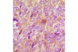 Immunohistochemistry (IHC) image for anti-Bone Morphogenetic Protein Receptor, Type IB (BMPR1B) antibody (ABIN7307574)