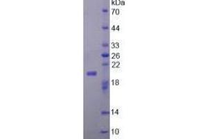 Image no. 2 for Fibroblast Growth Factor 22 (FGF22) (AA 26-162) (Active) protein (His tag) (ABIN5665797) (FGF22 Protein (AA 26-162) (His tag))