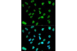 Immunofluorescence analysis of HeLa cell using KDM1A antibody. (LSD1 抗体  (AA 130-380))
