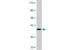 Western Blot detection against Immunogen (37. (PCDHGA2 抗体  (AA 223-331))