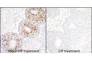 Immunohistochemistry (IHC) image for anti-Minichromosome Maintenance Complex Component 2 (MCM2) (pSer53) antibody (ABIN7449430) (Recombinant MCM2 抗体  (pSer53))