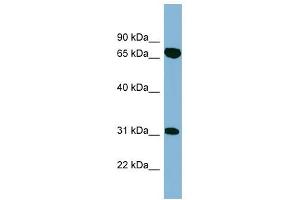HIRIP3 antibody used at 1 ug/ml to detect target protein. (HIRIP3 抗体  (Middle Region))