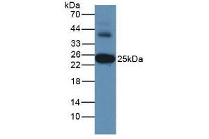 Detection of GSTa3 in Human Liver Tissue using Monoclonal Antibody to Glutathione S Transferase Alpha 3 (GSTa3) (GSTA3 抗体  (AA 1-222))