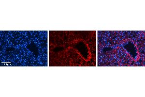 Rabbit Anti-MST1 Antibody Catalog Number: ARP45722_P050 Formalin Fixed Paraffin Embedded Tissue: Human Liver Tissue Observed Staining: Cytoplasm in hepatocytes Primary Antibody Concentration: 1:100 Other Working Concentrations: N/A Secondary Antibody: Donkey anti-Rabbit-Cy3 Secondary Antibody Concentration: 1:200 Magnification: 20X Exposure Time: 0. (MST1 抗体  (N-Term))