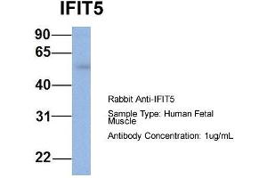 Host: Rabbit  Target Name: IFIT5  Sample Tissue: Human Fetal Muscle  Antibody Dilution: 1. (IFIT5 抗体  (Middle Region))
