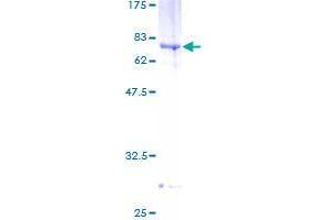 B3GNT5 Protein (AA 1-378) (GST tag)