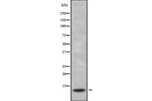 Western blot analysis S100G using HeLa whole cell lysates (S100G 抗体  (Internal Region))