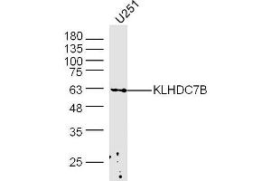 U251 lysates probed with KLHDC7B Polyclonal Antibody, Unconjugated  at 1:300 dilution and 4˚C overnight incubation. (KLHDC7B 抗体  (AA 431-530))