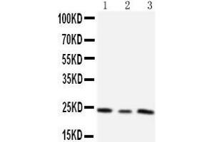 Anti-TIMP4 antibody,  Western blotting Lane 1:  Cell Lysate Lane 2: HELA Cell Lysate Lane 3: SMMC Cell Lysate (TIMP4 抗体  (C-Term))